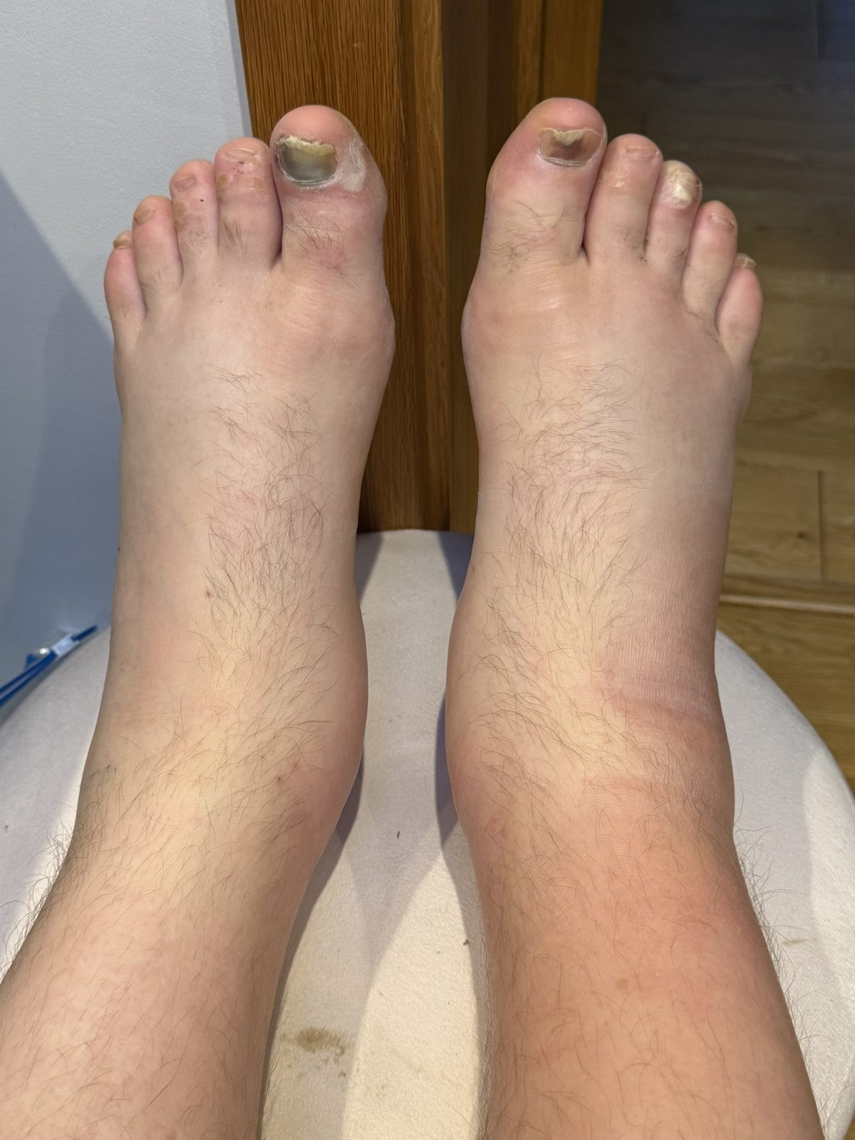 Afterwards: my feet. The less said the better