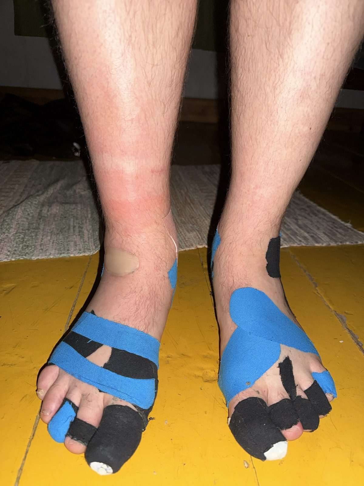 Halfway: my feet, held together with tape and optimism